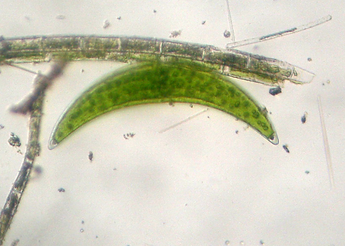 Closterium sp. (Closteriaceae)